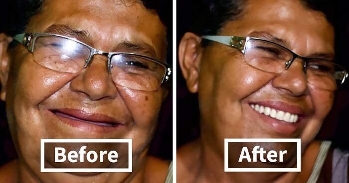 Brazilian Dentist Travels To Treat The Teeth Of Poor People For Free And Here Are 30 Transformations