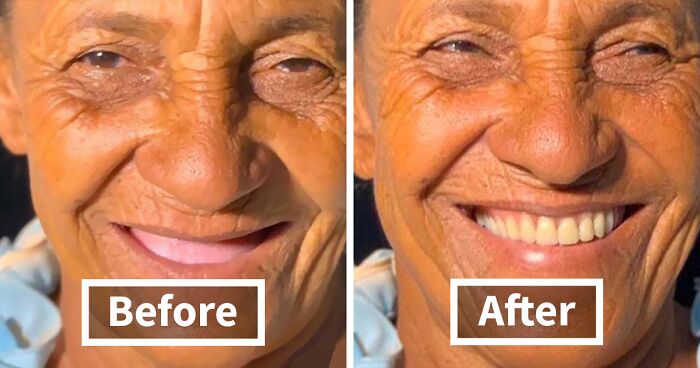 Brazilian Dentist Travels To Fix The Teeth Of Less-Fortunate People For Free And Here Are 31 New Transformations