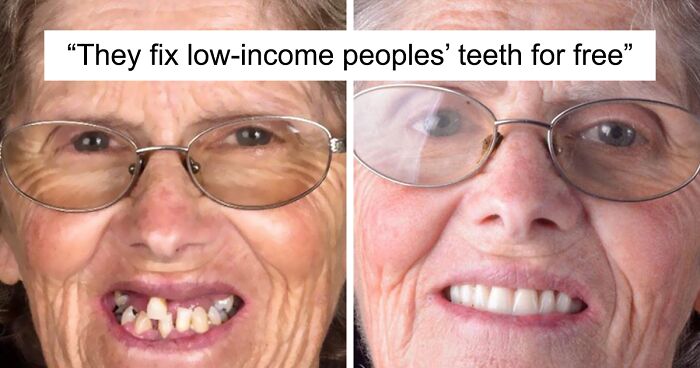 Brazilian Dentist Travels To Treat The Teeth Of Poor People For Free And Here Are 30 Transformations