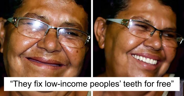 Brazilian Dentist Travels To Treat The Teeth Of Poor People For Free And Here Are 30 Transformations