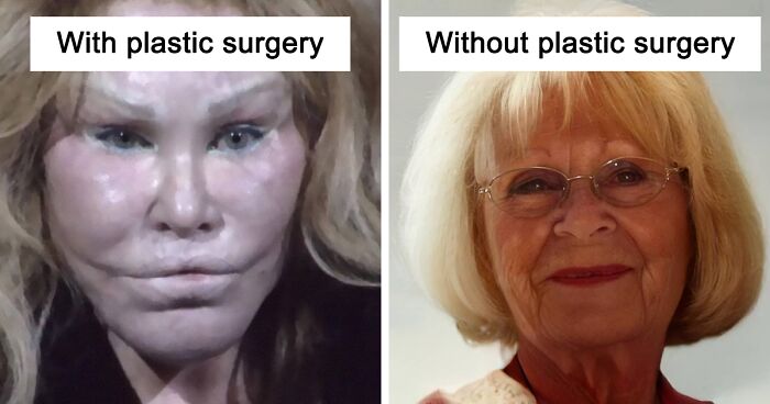I'm a plastic surgeon, the common anti-aging mistake that's giving
