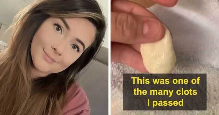 Woman Shares A Video Of Clots She Had To Pump Out After Developing Mastitis When Breastfeeding