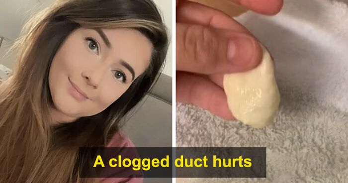 Mom Goes Septic From Mastitis, Shows What Came Out Of Her Breast To Warn Others