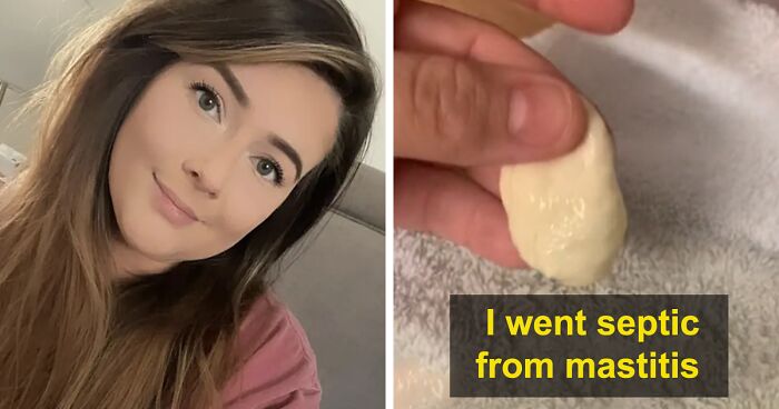 Mom Shares How She Went Septic Because Doctors Didn't Believe She Had A Clogged Milk Duct, Urges Others To Trust Their Gut