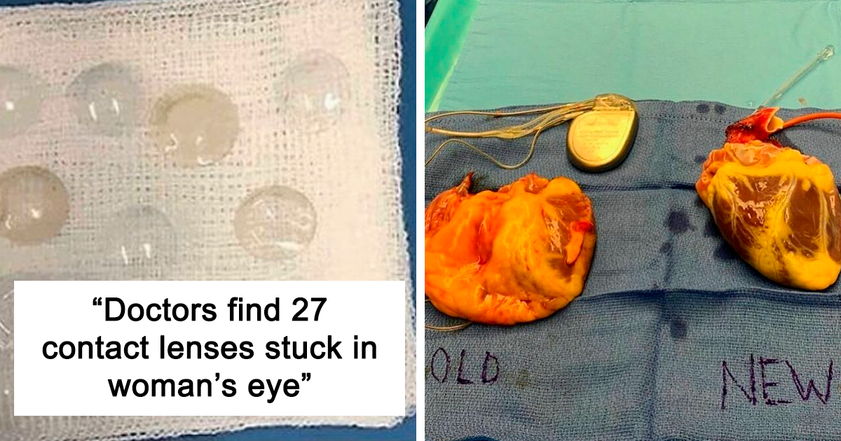 50-amazing-medical-cases-that-are-interesting-and-bizarre-at-the-same