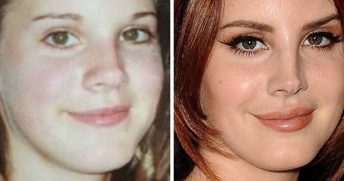 This Instagram Account Points Out How Much Celebrity Faces Have Changed After Fame (70 Pics)