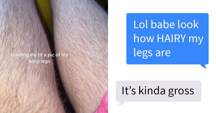 Woman Makes A TikTok About How Her Boyfriend Hates Her Hairy Legs, Asks 