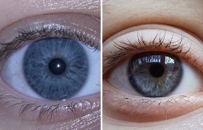 Hey Pandas, Share A Picture Of Your Eye Color (Closed)