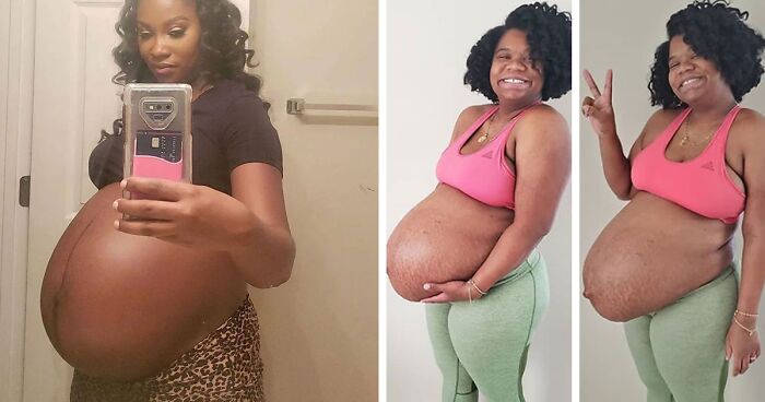 30 Mothers Are Sharing Realistic Pictures Of Baby Bumps And Pregnant Bodies To Fight Toxic Standards