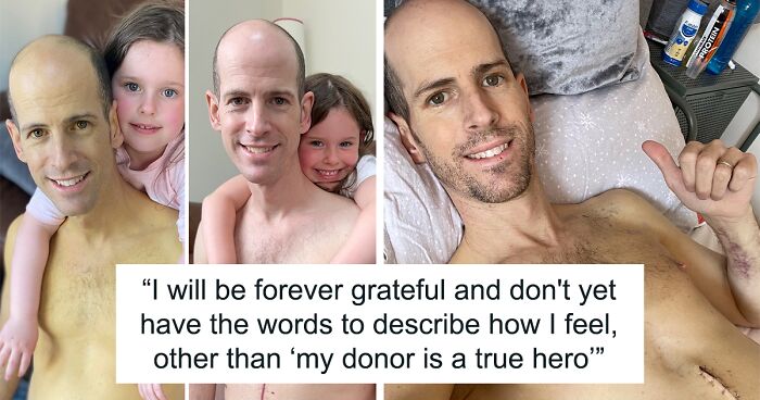 Man Shares Pictures Taken Before And After Vital Liver Transplant