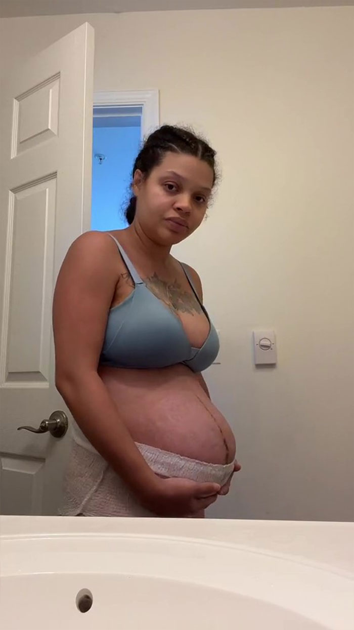TikTok Mom Exposes Her Postpartum Journey To Combat Unrealistic, postpartum