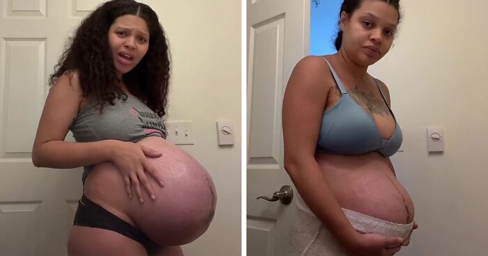 TikTok Mom Documents Her Raw Postpartum Journey, Goes Viral With Over 19M Views