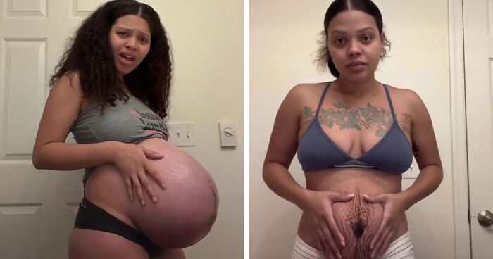 TikTok Mom Exposes Her Postpartum Journey To Combat Unrealistic Depictions Of Post-Pregnancy Bodies