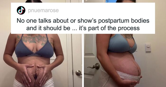 TikTok Mom Exposes Her Postpartum Journey To Combat Unrealistic Depictions Of Post-Pregnancy Bodies