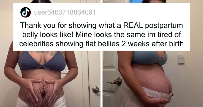 Folks Online Are Applauding This Mom Who Addresses Unrealistic Ideas Of Post-Baby Bodies By Documenting Her Postpartum Period