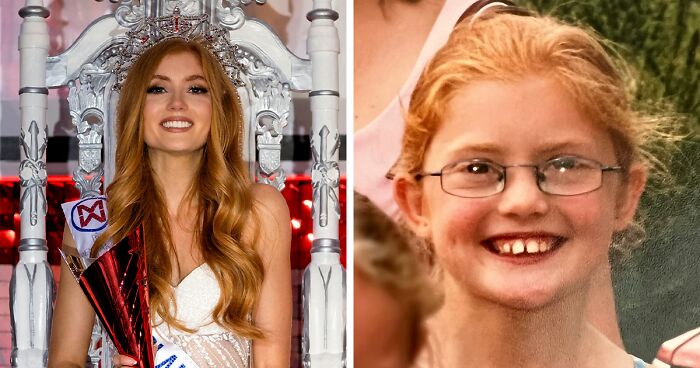 Woman Who Was Bullied At School For The Color Of Her Hair Is First Redhead Miss England Crowned In 94 Years