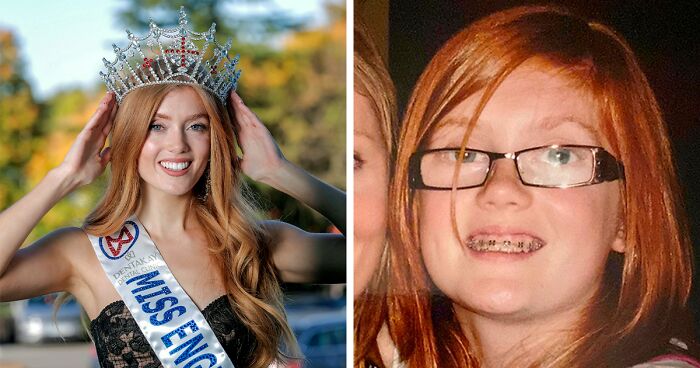 Woman Who Was “Spat At” And “Burned” At School For Having Ginger Hair Grows Up To Be Crowned Miss England