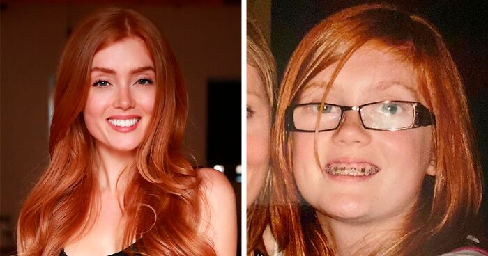 Woman Who Was “Spat At” And “Burned” At School For Having Ginger Hair Grows Up To Be Crowned Miss England