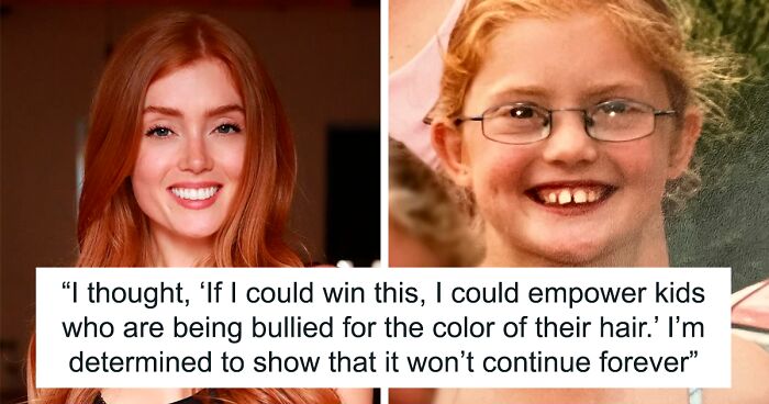 Woman Who Was “Spat At” And “Burned” At School For Having Ginger Hair Grows Up To Be Crowned Miss England