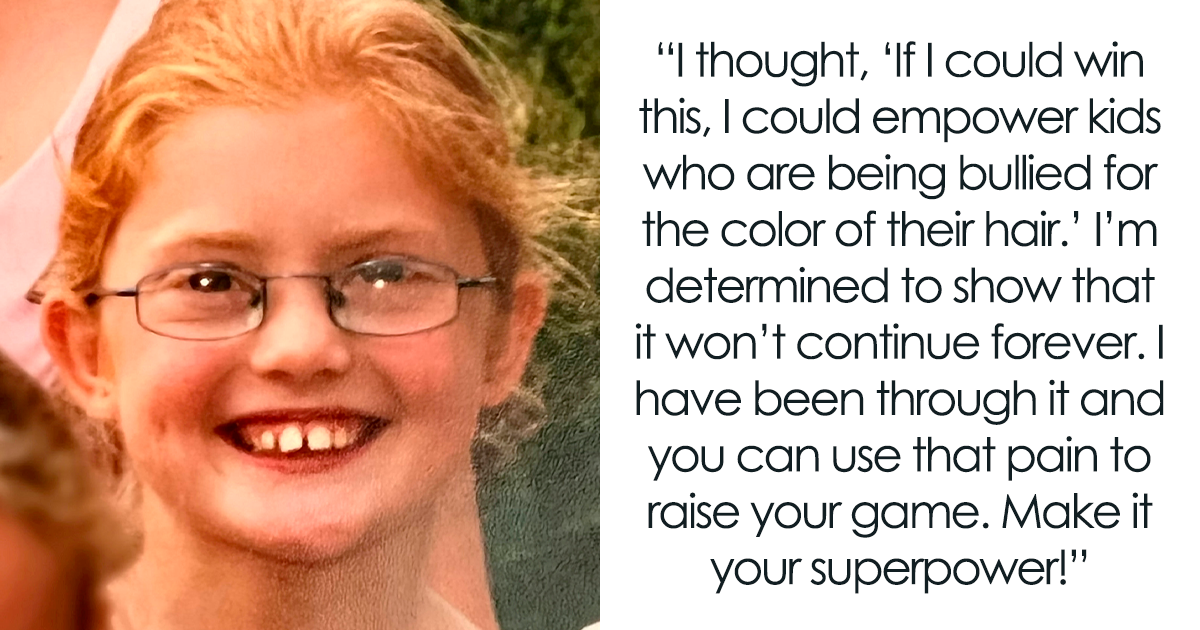 Woman Who Was Spat At And Burned At School For Having Ginger Hair Grows Up To Be Crowned
