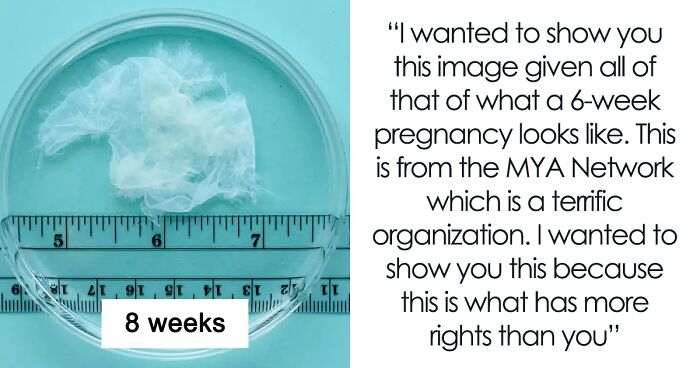 To Bust Myths Surrounding Abortion, Woman Sheds Light On These 5 Images Showing What Pregnancy Actually Looks Like Before 10 Weeks