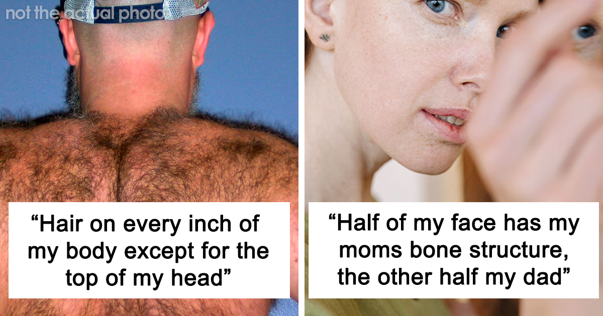 30 Times People Lost The Gene Lottery According To This Viral Thread Bored Panda 