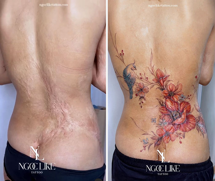 50 Times People Asked To Cover Up Their Scars, And This Tattoo Artist  Nailed It (New Pics)