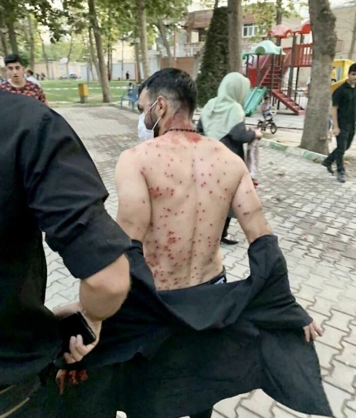 Man Shielded Many Women And Took All Pallets Shotgun On Himself During Anti Hizab Protest In Tehran