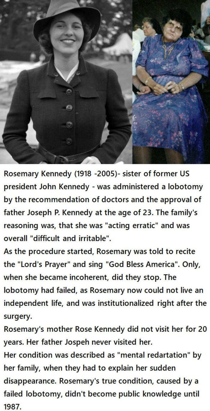 Rosemary Kennedy And Lobotomy