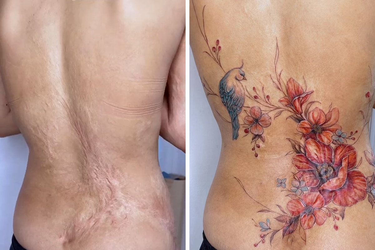 50 Times People Asked To Cover Up Their Scars And This Tattoo Artist  Nailed It New Pics  Bored Panda