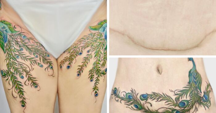 This Tattoo Artist Restores People’s Confidence In Themselves By Covering Up Their Scars, Burns, And Blemishes (100 New Pics)