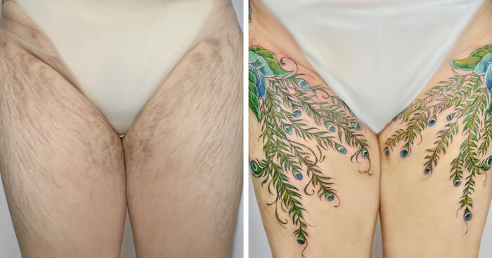 This Tattoo Artist Helps People Feel Confident In Their Bodies By Covering Up Their Scars With Tattoos (100 New Pics)