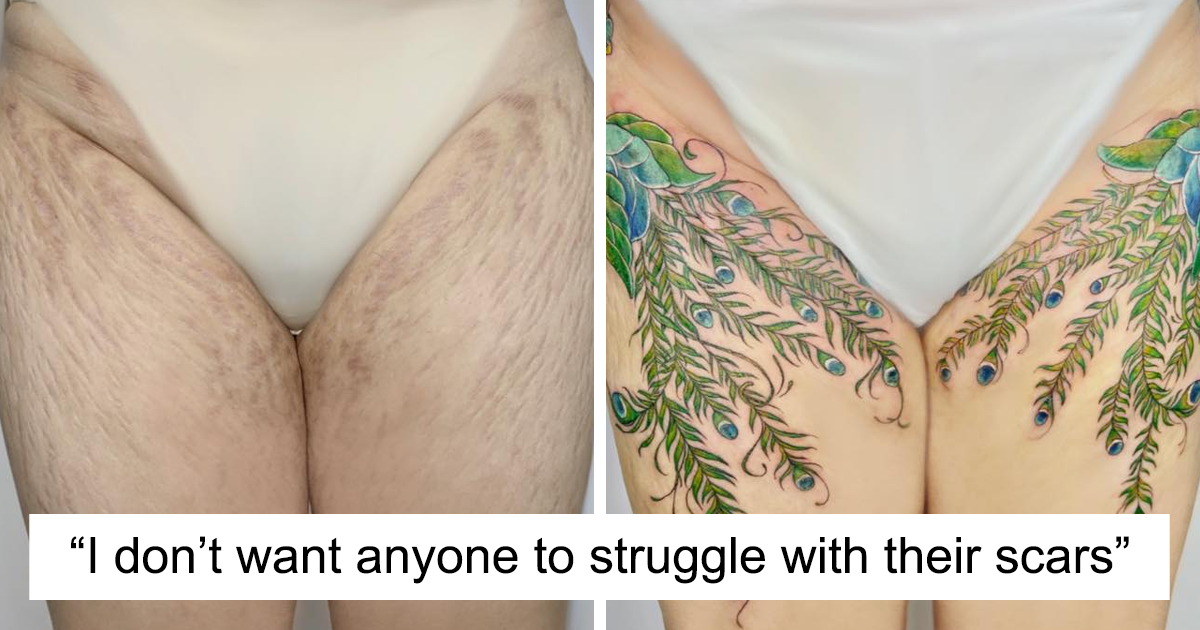 50 Times People Asked To Cover Up Their Scars, And This Tattoo
