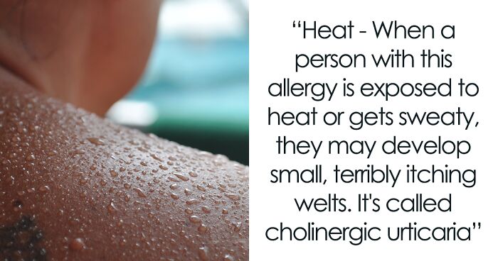 65 Weird Allergies That Actually Exist