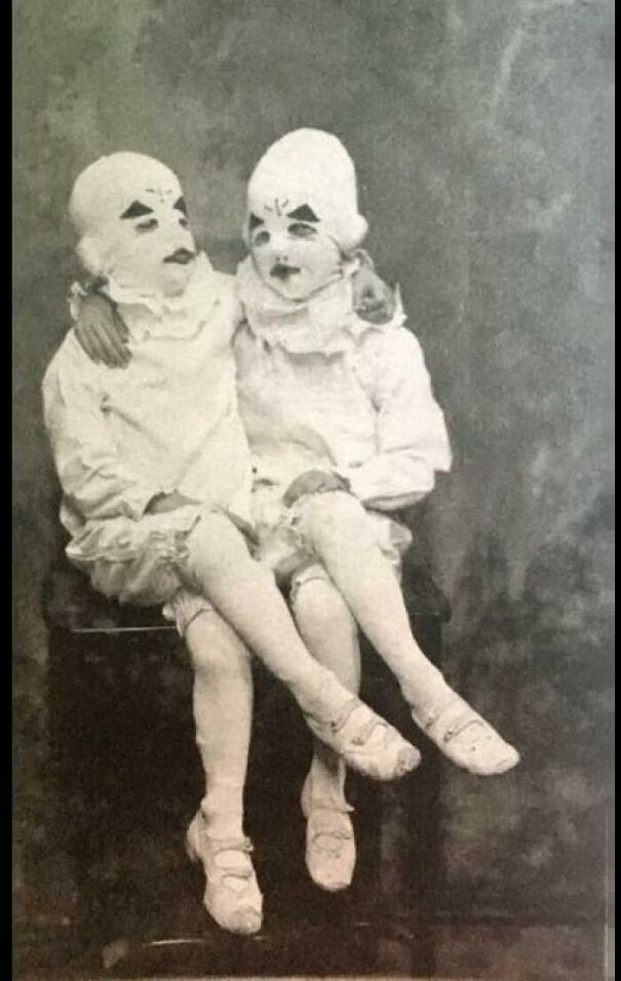 The Twins That Inspired The Twins Of Tim Burton's Miss Pergerine's Home For Peculiar Children, C. 1900s