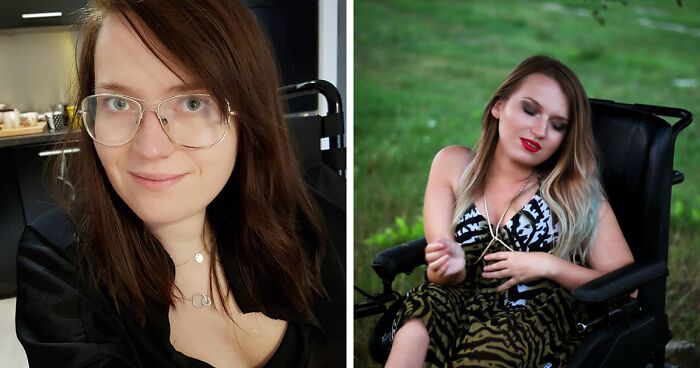 I’m A Disabled Body-Positive Model, A Game Developer, A Journalist, And A Horror Writer, And Through My Social Media, I Want To Inspire Others (34 Pics)