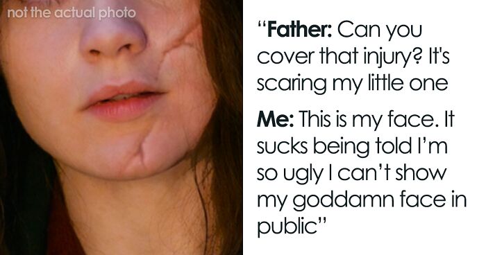 Woman Asks If She Was Wrong To Refuse To Cover Her Facial Scar After This Dad Told Her It Was Scaring His Son