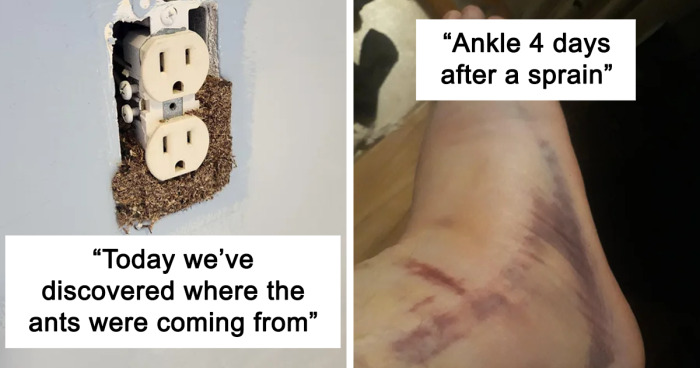 “Hurts To Look At”: 42 Disturbing Pics From The “Make Me Suffer” Online Community (New Pics)