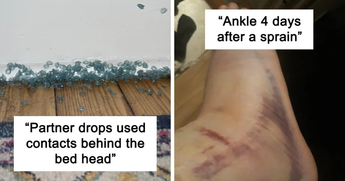 “Make Me Suffer”: 42 Of The Most Painful Images Posted By This Online Community (New Pics)