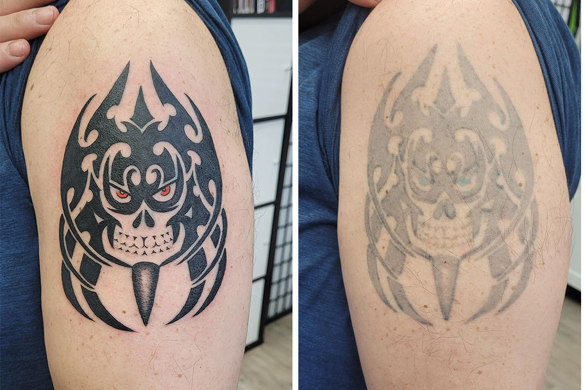 My new Medusa tattoo done by Chelsea at fade to Black tattoos (fort Worth)  | Medusa tattoo, Hand tattoos, Tattoos