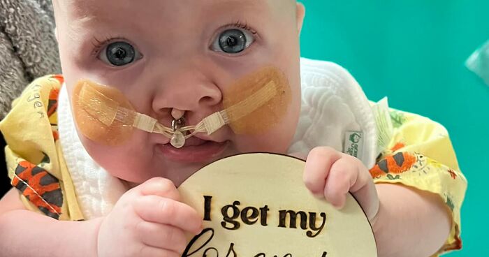 The Heart-Warming Story Of One Photograph: A Photographer Took A Photo Of A Baby With A Cleft Lip, Making Her Story Go Viral And Inspire Thousands Of People Around The World Who Have A Similar Condition