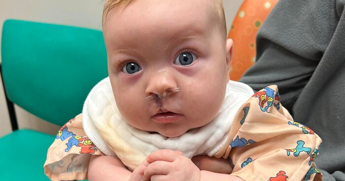 A Photo Of A Baby Girl From Texas Born With Cleft Lip And Palate Went Viral And Inspired Thousands Of People With The Same Condition Who Share Their Stories On Social Media