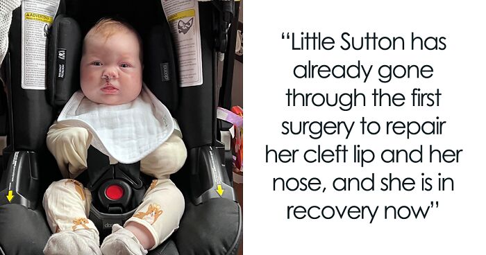 This Baby Girl From Texas Was Born With Cleft Lip And Palate, Her Photograph Went Viral On Social Media, Inspiring People Around The World Who Have A Similar Condition