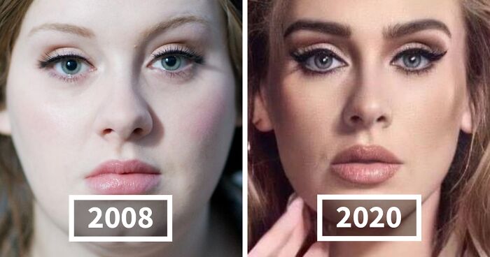 36 Before-And-After Photos That Illustrate The Remarkable Changes In Celebrity Faces (New Pics)