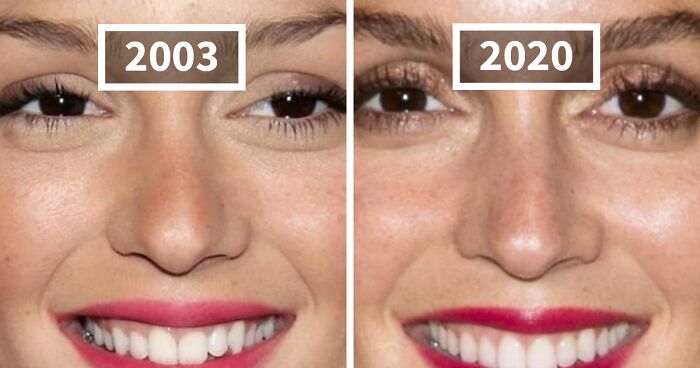 How Celebrity Faces Have Changed Over The Years: 36 New Before-And-After Pics