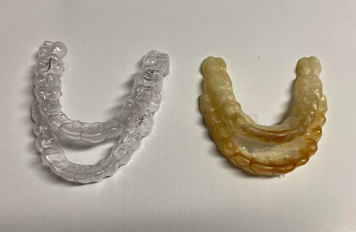 New Retainer vs. Old Retainer