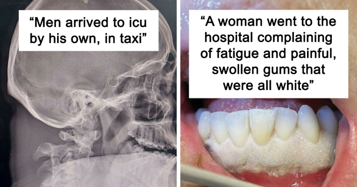 46 Interesting Medical Cases That You Might Not Have Seen Before (New Pics)