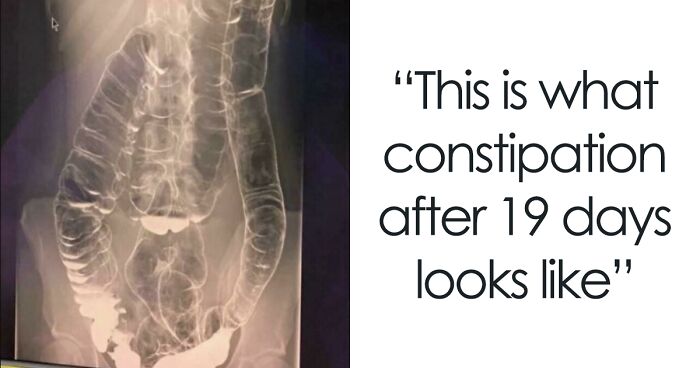 This Online Group Is All About Interesting And Inspiring Medical Cases (46 New Pics)