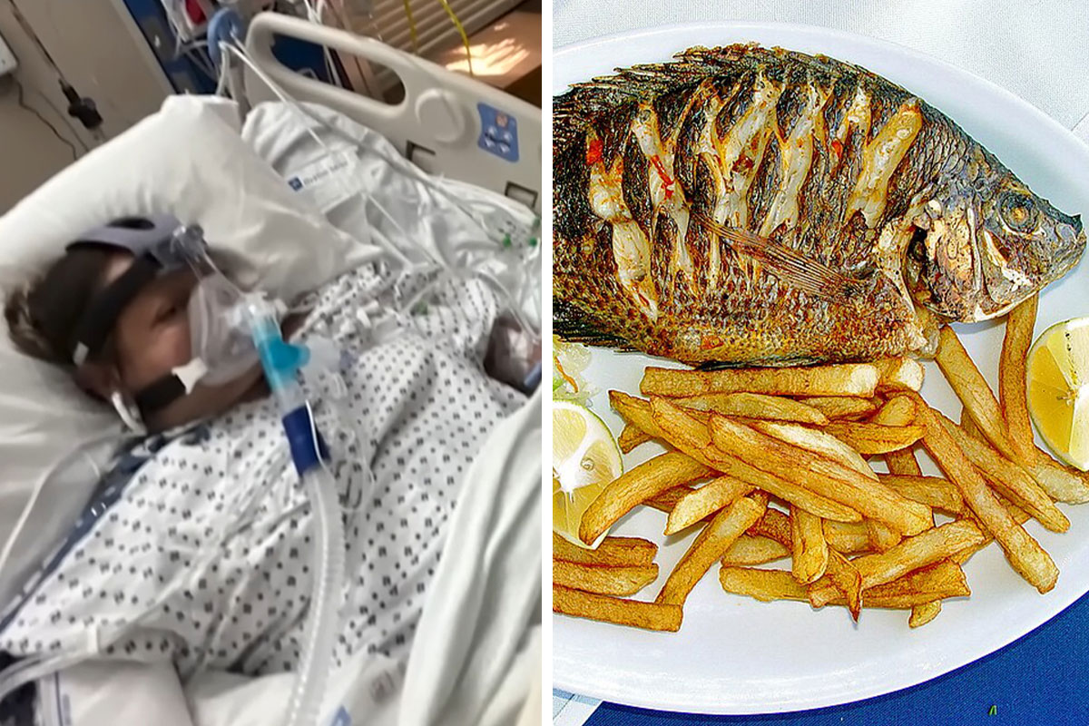 CA Mom Has Limbs Amputated After Eating Tainted Tilapia - Comic Sands