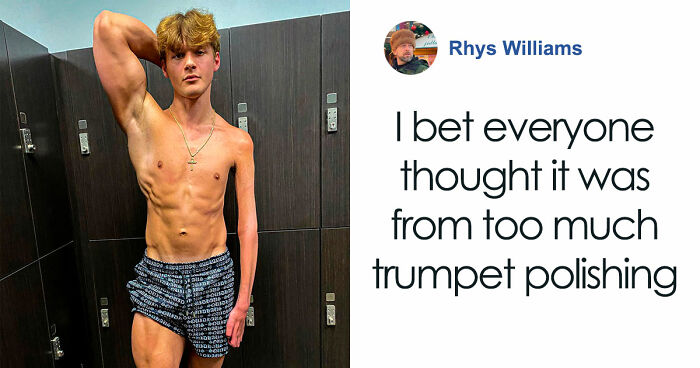 Fitness Influencer Moves People After Revealing Why One Arm Looks More Muscular Than The Other